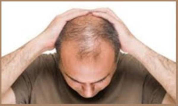 مشکلات تیروئید و ریزش مو مسائل تیروئید و ریزش مو